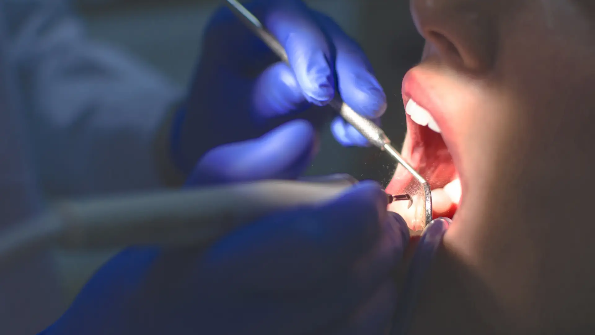 Restorative Dentistry | Dr. Enrico Cogo | Cometic Dentist in Dubai
