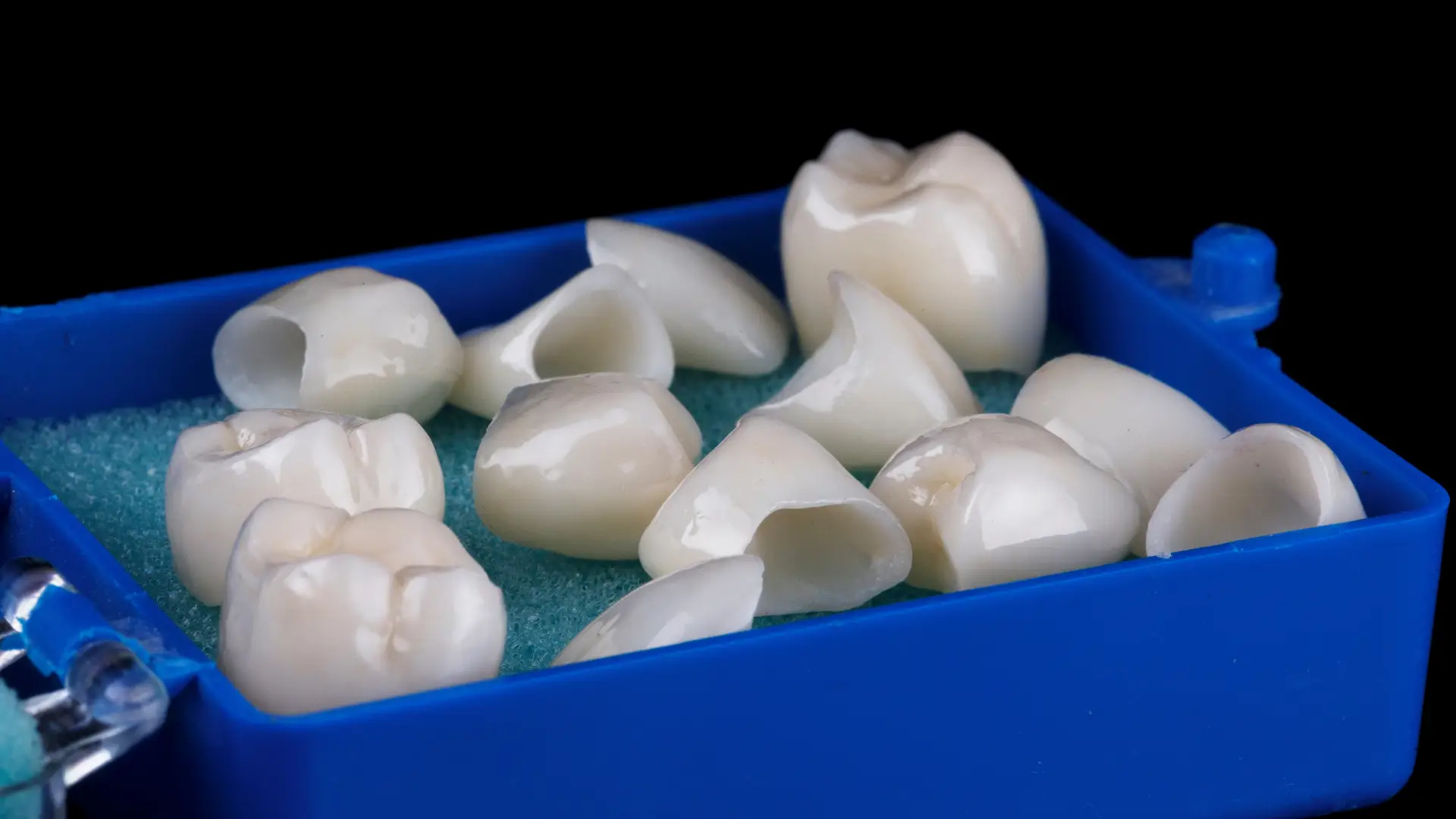 Crown and Bridges | Dr. Enrico Cogo | Cometic Dentist in Dubai