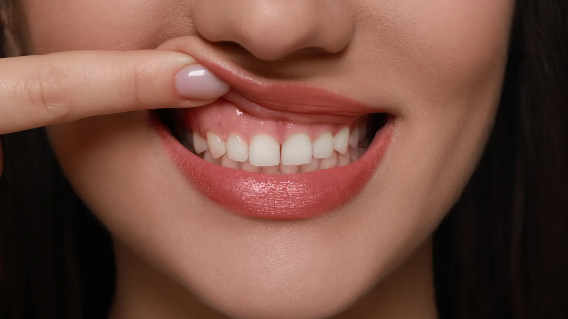 Healty Gums | Dr. Enrico Cogo | Cometic Dentist in Dubai